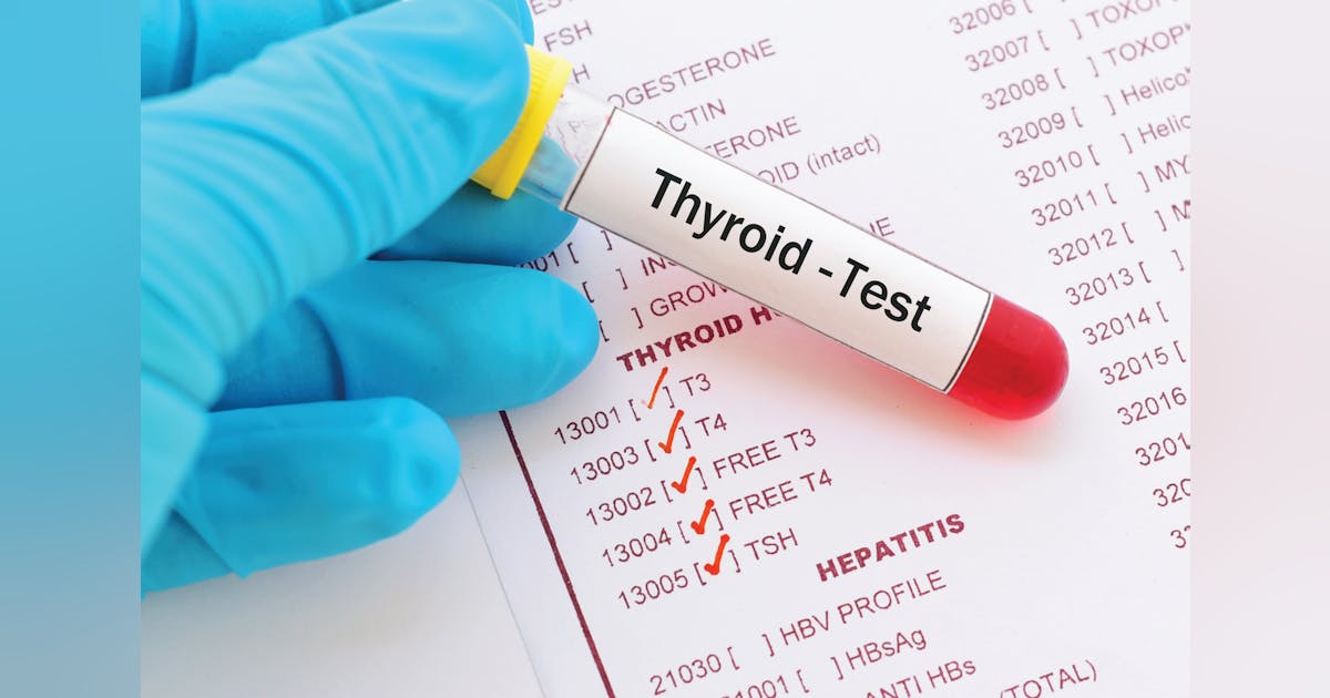 Endocrinology screening and reasons behind delayed testing | MLO Online