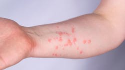 Adobe Stock 445375949 62d981d40aa16 Adobe Stock 445375949 62d981d40aa16