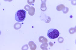 Courtesy of the CDC Courtesy of the CDC