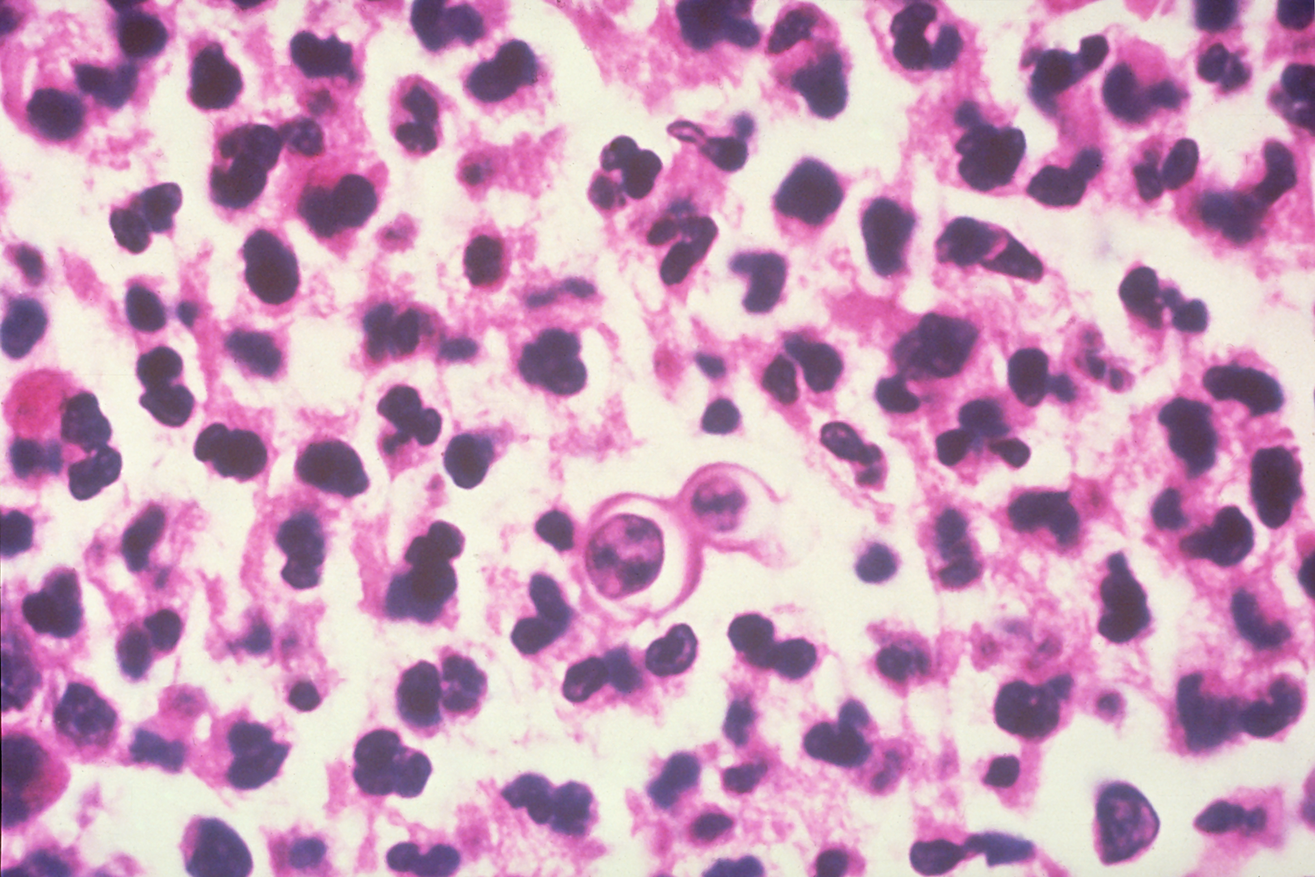 Courtesy of the CDC