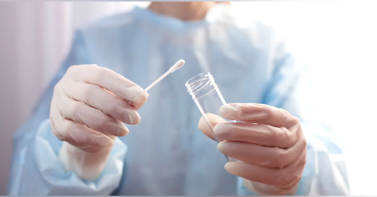Monkeypox Lab Specimen Types For monkeypox testing, use lesion swab samples to avoid false results ...