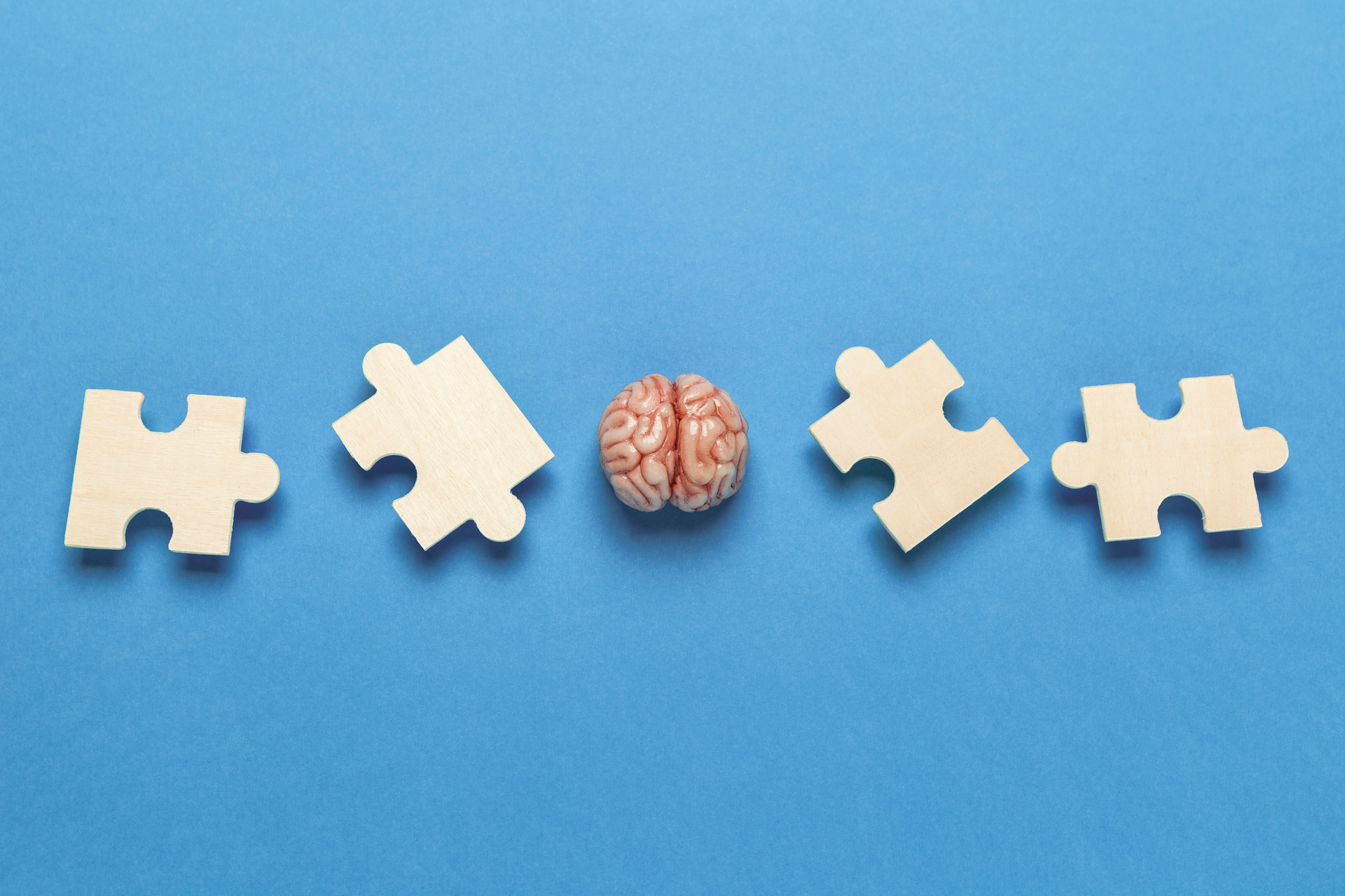 Adobe Alzheimers Adobe Stock 338175154 62c84c85bae45