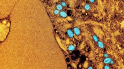 Courtesy of NIH Courtesy of NIH