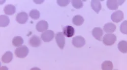 Courtesy of the CDC