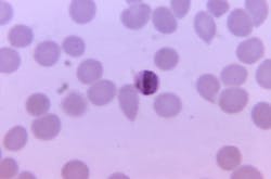 Courtesy of the CDC Courtesy of the CDC