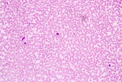 Adobe Stock 232084334 6307cdb1dedfe Adobe Stock 232084334 6307cdb1dedfe