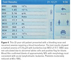 Figure4a Spfeature Figure4a Spfeature