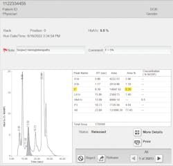 Figure 1: HbF detected on CE-HPLC A1c method — it provides information about the risk of possible interacting hemoglobinopathy. Figure 1: HbF detected on CE-HPLC A1c method — it provides information about the risk of possible interacting hemoglobinopathy.