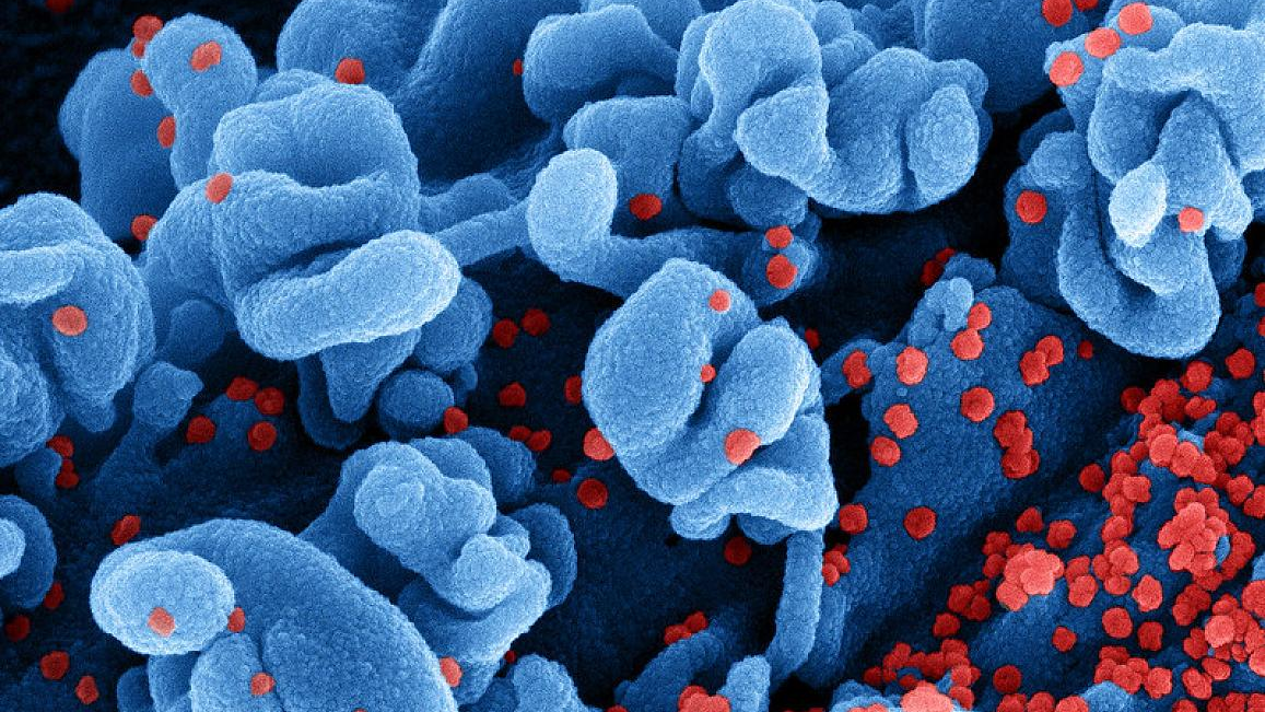 Colorized scanning electron micrograph of a cell infected with the Omicron strain of SARS-CoV-2 virus particles (red), isolated from a patient sample. NIAID.