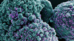 Colorized scanning electron micrograph of a cell infected with the Omicron strain of SARS-CoV-2 virus particles (purple), isolated from a patient sample. NIAID.