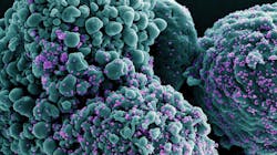 Colorized scanning electron micrograph of a cell infected with the Omicron strain of SARS-CoV-2 virus particles (purple), isolated from a patient sample. NIAID. Colorized scanning electron micrograph of a cell infected with the Omicron strain of SARS-CoV-2 virus particles (purple), isolated from a patient sample. NIAID.