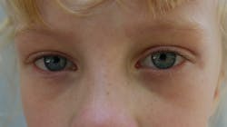 Adobe Stock 171775611 631b55ecd9ecf Adobe Stock 171775611 631b55ecd9ecf