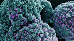 Colorized scanning electron micrograph of a cell infected with the Omicron strain of SARS-CoV-2 virus particles (purple), isolated from a patient sample. NIAID.