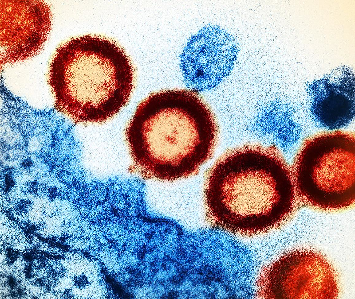 Transmission electron micrograph of HIV-1 virus particles (red) replicating from the plasma membrane of an infected H9 T cell (blue). NIAID.