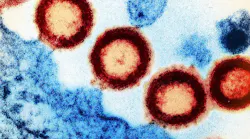 Transmission electron micrograph of HIV-1 virus particles (red) replicating from the plasma membrane of an infected H9 T cell (blue). NIAID.
