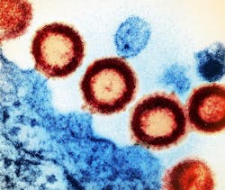 Transmission electron micrograph of HIV-1 virus particles (red) replicating from the plasma membrane of an infected H9 T cell (blue). NIAID. Transmission electron micrograph of HIV-1 virus particles (red) replicating from the plasma membrane of an infected H9 T cell (blue). NIAID.