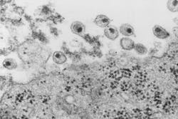 Courtesy of the CDC Courtesy of the CDC