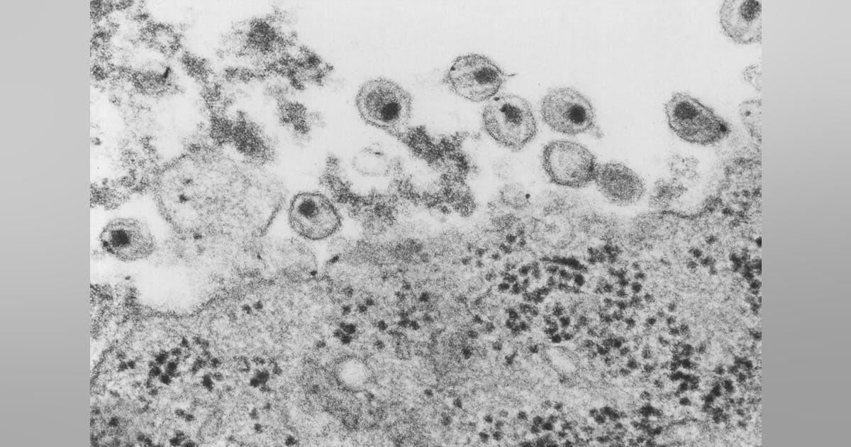 How Stealthy HIV Evades Drugs and Immunity