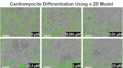 2D model showing how the pluripotent stem cells react to human relevant doses of cadmium over 8 days. From the control in the first panel, to the last panel, researchers can see how the differentiation to cardiomyocytes is inhibited with different doses of cadmium. Courtesy of the NIH.