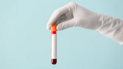 Adobe Stock 333108331 6399fba85302b Adobe Stock 333108331 6399fba85302b