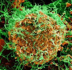 Colorized scanning electron micrograph of Ebola virus particles (green) both budding and attached to the surface of infected VERO E6 cells (orange). NIAID.