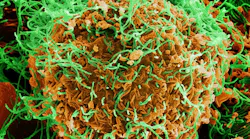 Colorized scanning electron micrograph of Ebola virus particles (green) both budding and attached to the surface of infected VERO E6 cells (orange). NIAID.