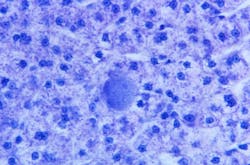 Courtesy of the CDC Courtesy of the CDC