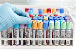 Adobe Stock 73684018 638a270b067c4 Adobe Stock 73684018 638a270b067c4