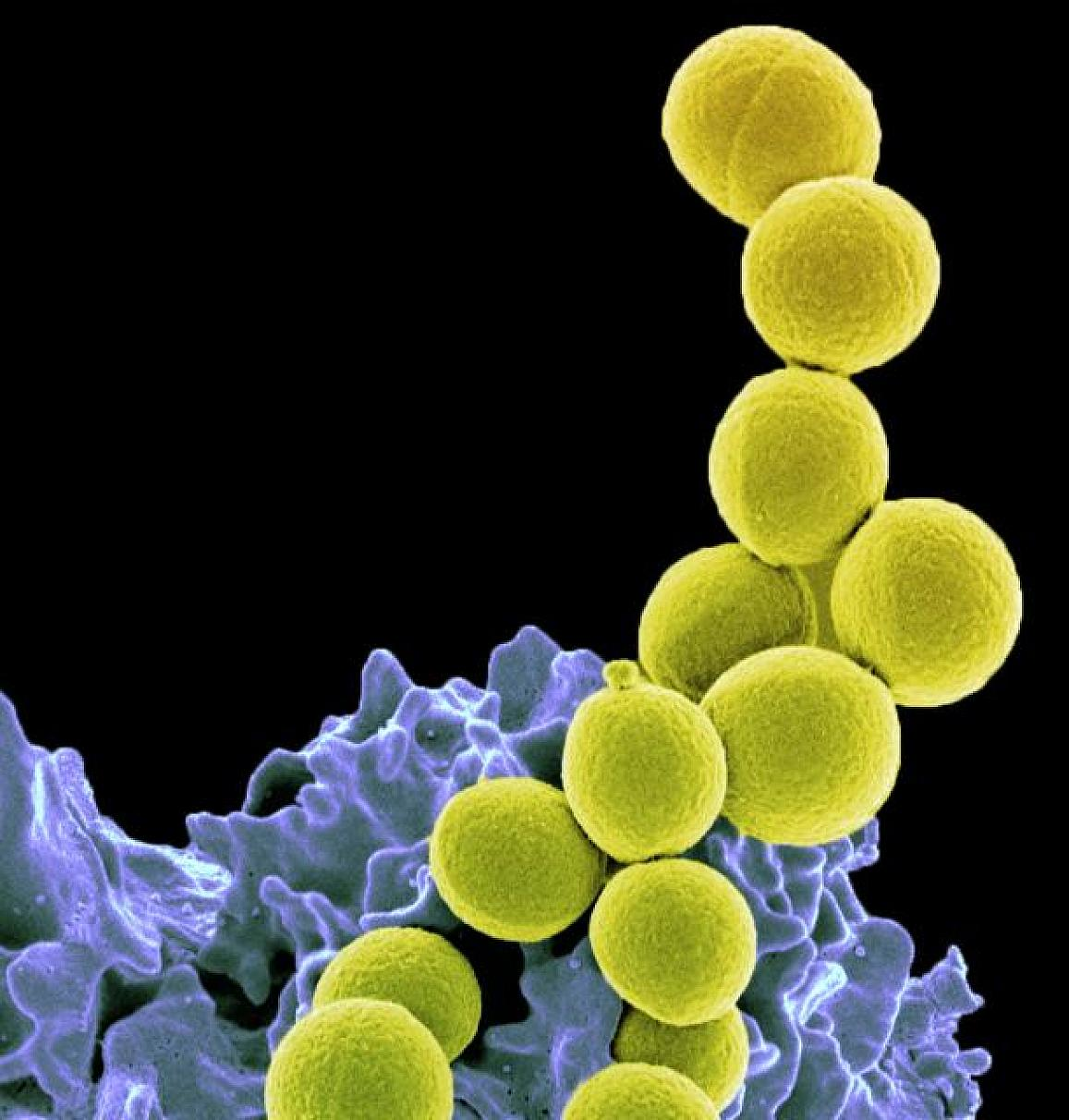 MRSA (yellow) being ingested by neutrophil (purplish blue). NIAID.