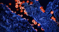 Transmission electron micrograph of HIV-1 virus particles (red) budding and replicating from a segment of a chronically infected H9 cell (blue). Particles are in various stages of maturity; arc/semi-circles are immature particles that have started to form but are still part of the cell. Immature particles slowly change morphology into mature forms and exhibit the classic “conical or spherical-shap, NIAID.