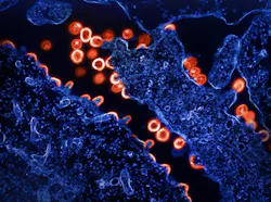 Transmission electron micrograph of HIV-1 virus particles (red) budding and replicating from a segment of a chronically infected H9 cell (blue). Particles are in various stages of maturity; arc/semi-circles are immature particles that have started to form but are still part of the cell. Immature particles slowly change morphology into mature forms and exhibit the classic “conical or spherical-shap, NIAID.