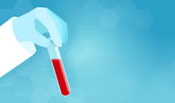 Adobe Stock 307495082 1 63d2a7c80180f Adobe Stock 307495082 1 63d2a7c80180f