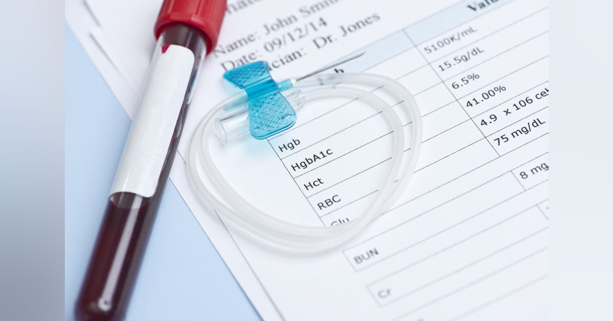 Importance of hemoglobin A1c testing for diabetes diagnosis and
