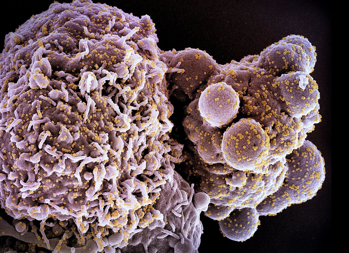 Colorized scanning electron micrograph of a cell (pink) infected with the Omicron strain of SARS-CoV-2 virus particles (yellow), isolated from a patient sample, NIAID.