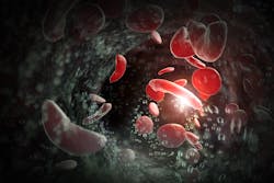 Adobe Stock 398342322 63dbde253aeb2 Adobe Stock 398342322 63dbde253aeb2