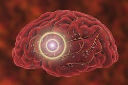 Dreamstime Xxl 111511249 63f3f3a223de5 Dreamstime Xxl 111511249 63f3f3a223de5