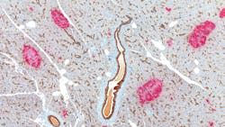 Dreamstime Xxl 29278602 63e6607972598 Dreamstime Xxl 29278602 63e6607972598