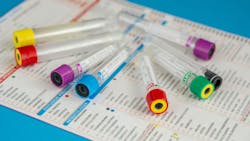 Adobe Stock 216855468 64021ed9efe3d Adobe Stock 216855468 64021ed9efe3d