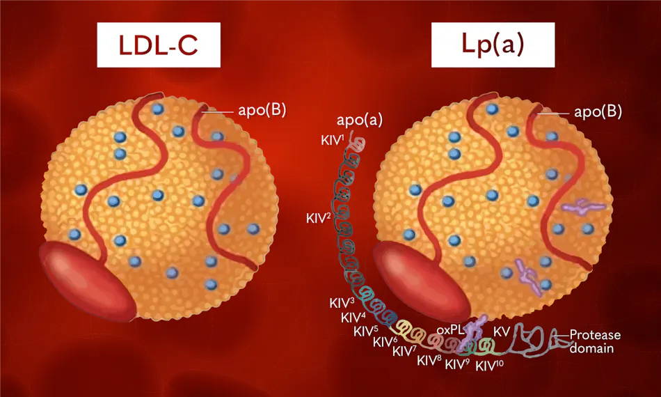 Lp Condition Novel and classical insights into Lp(a) concentration and the effects ...