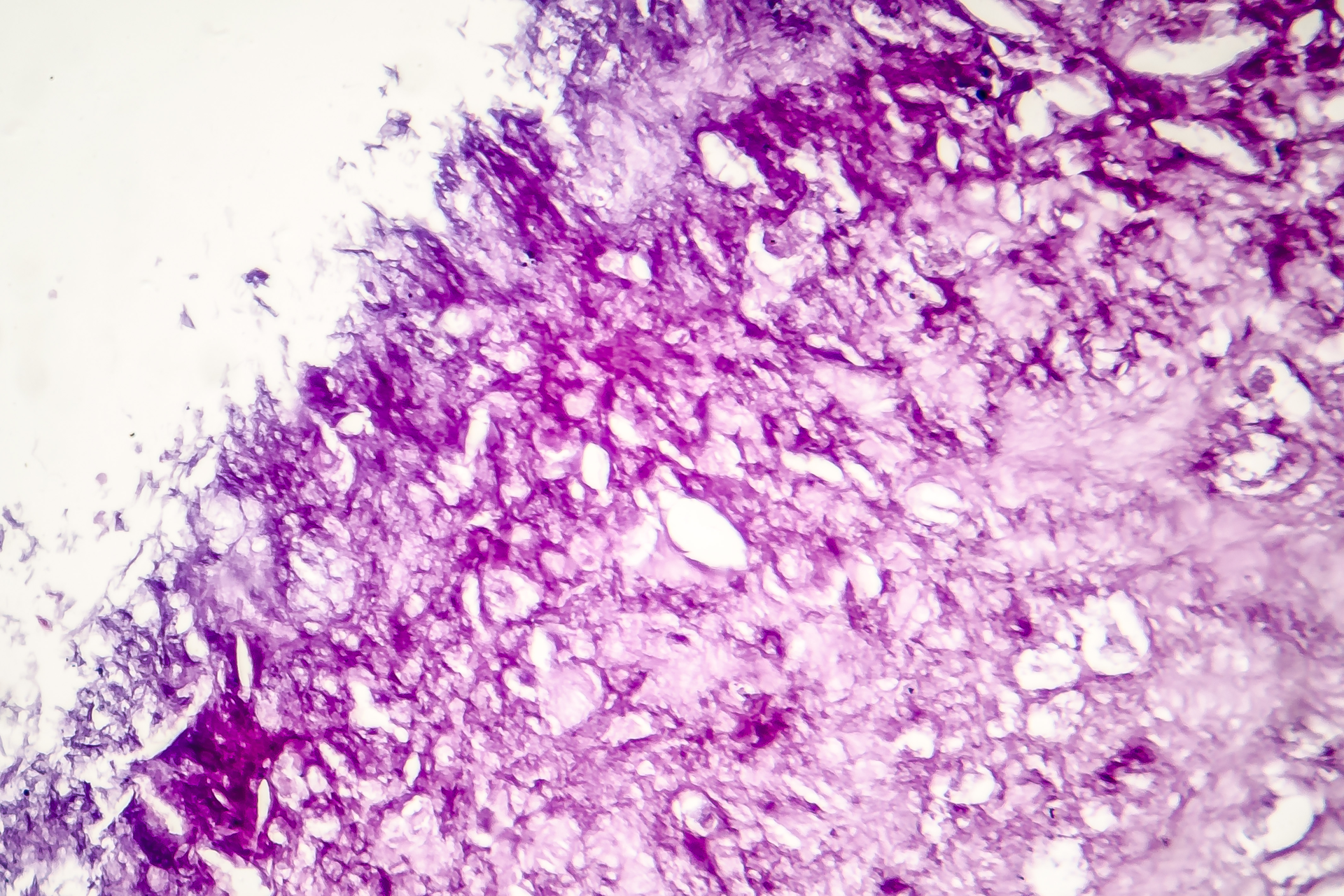 Dreamstime Xxl 128779033 64021955cdcb3