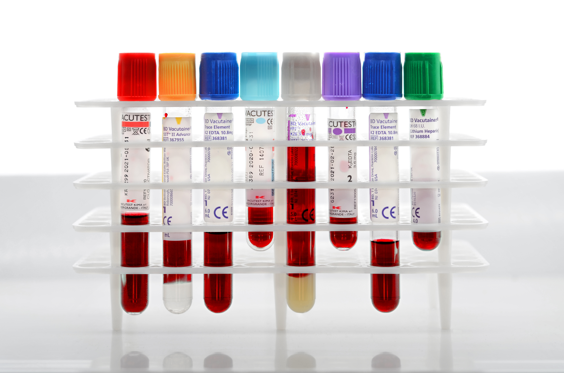 Epilepsy could easier to pinpoint with blood test Medical