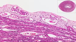 Dreamstime Xxl 18889635 642444f1eec1f Dreamstime Xxl 18889635 642444f1eec1f