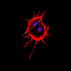 Dreamstime Xxl 76259680 6409fb9eb5bf0 Dreamstime Xxl 76259680 6409fb9eb5bf0