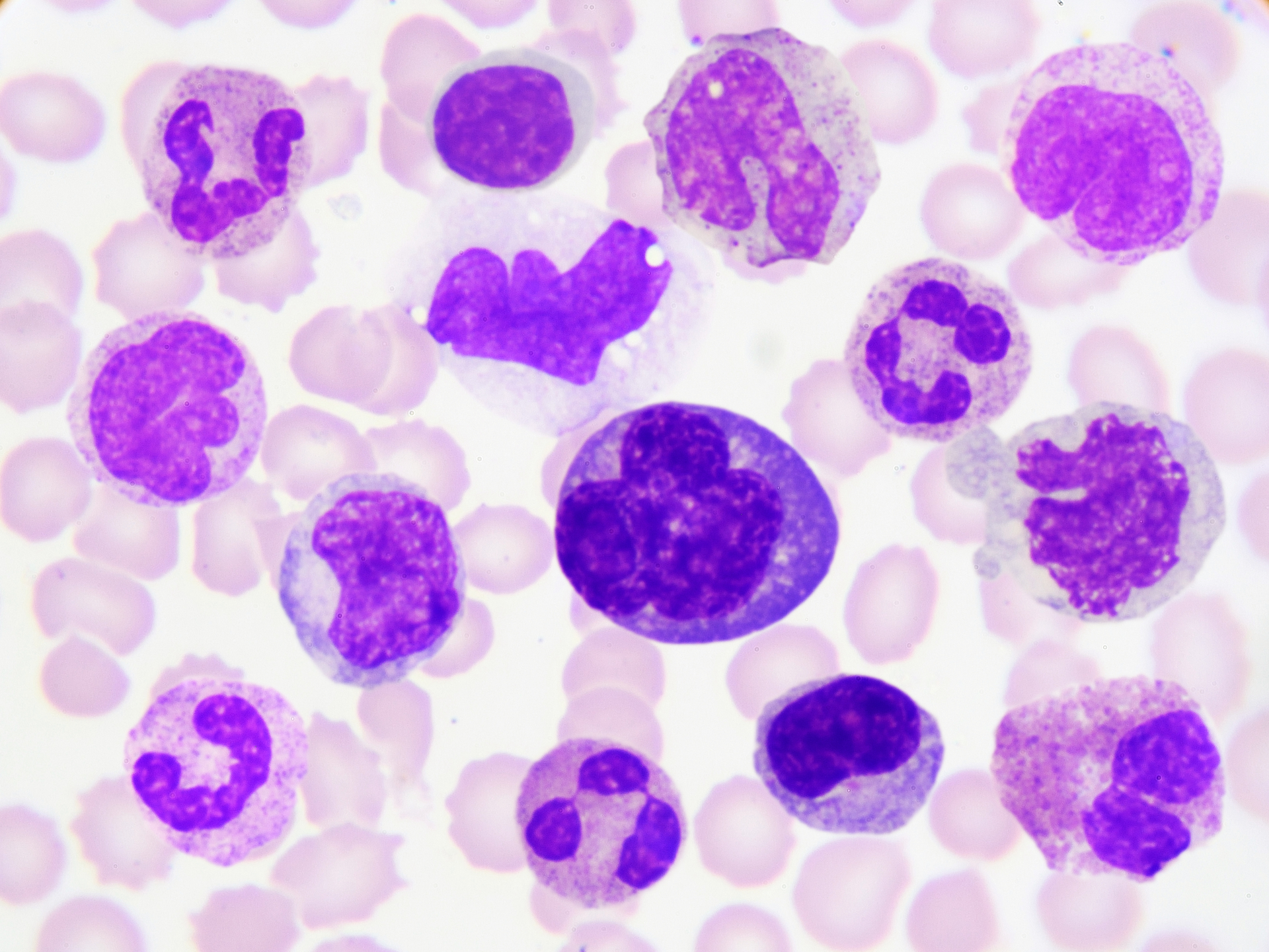 Dreamstime Xxl 96831347 64244c74a87c3