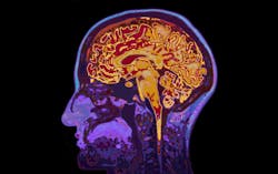 Dreamstime Xxl 63218233 64356a14a8423 Dreamstime Xxl 63218233 64356a14a8423