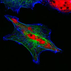 Dreamstime Xxl 75388613 6438190abed38 Dreamstime Xxl 75388613 6438190abed38