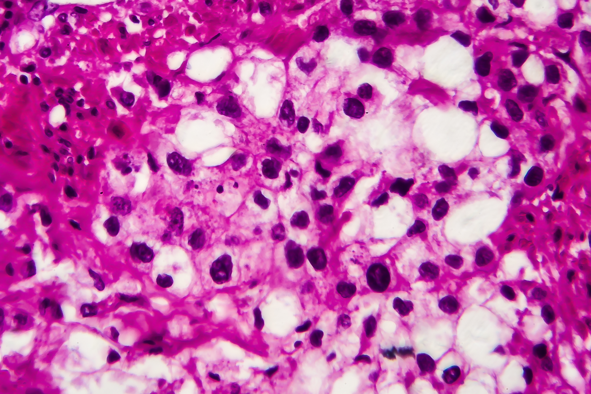 Dreamstime Xxl 163942834 647f49ae274ba