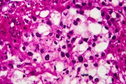 Dreamstime Xxl 163942834 647f49ae274ba Dreamstime Xxl 163942834 647f49ae274ba