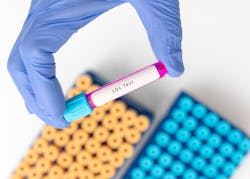 Dreamstime Xxl 267193525 649c419d17222 Dreamstime Xxl 267193525 649c419d17222