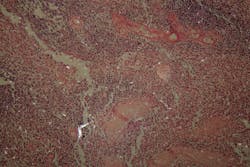 Dreamstime Xxl 87325090 6499a036516e4 Dreamstime Xxl 87325090 6499a036516e4